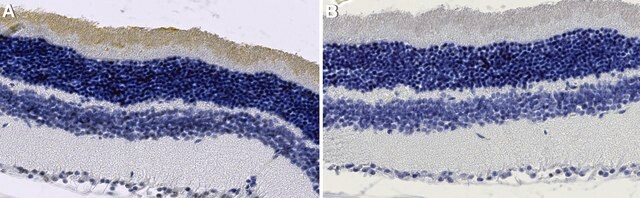 Anti-Guanylate cyclase 1 Antibody, clone IS4