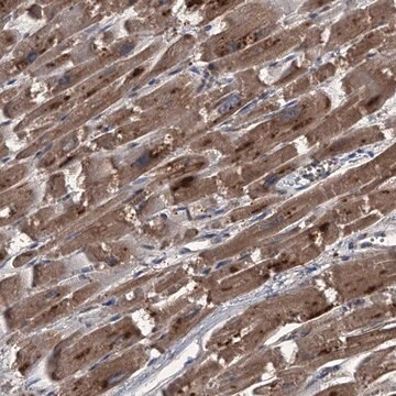 Anti-MAPKAP1 antibody produced in rabbit Prestige Antibodies&#174; Powered by Atlas Antibodies, affinity isolated antibody, buffered aqueous glycerol solution, ab1