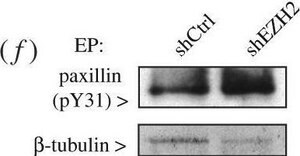 Anti-Tubulin Antibody, beta, clone KMX-1 clone KMX-1, Chemicon&#174;, from mouse