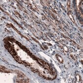 Monoclonal Anti-ACTB antibody produced in mouse Prestige Antibodies&#174; Powered by Atlas Antibodies, clone CL3868, purified immunoglobulin, buffered aqueous glycerol solution