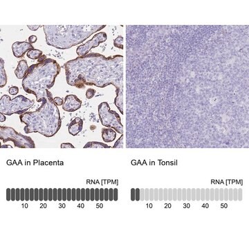 Anti-GAA antibody produced in rabbit Prestige Antibodies&#174; Powered by Atlas Antibodies, affinity isolated antibody, buffered aqueous glycerol solution