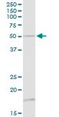Anti-TUBB1 antibody produced in rabbit purified immunoglobulin, buffered aqueous solution