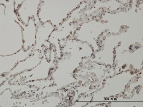 Monoclonal Anti-PIM1 antibody produced in mouse clone 6A2, purified immunoglobulin, buffered aqueous solution