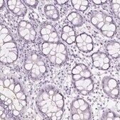 Anti-HBQ1 antibody produced in rabbit Prestige Antibodies&#174; Powered by Atlas Antibodies, affinity isolated antibody, buffered aqueous glycerol solution