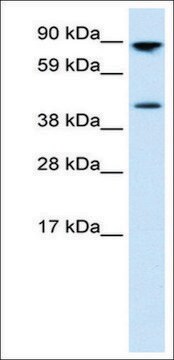 Anti-ETV4 antibody produced in rabbit affinity isolated antibody