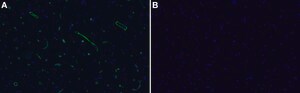 Anti-Laminin &#945;2 80 kDa Antibody, clone 5H2 ZooMAb&#174; Mouse Monoclonal recombinant, expressed in HEK 293 cells
