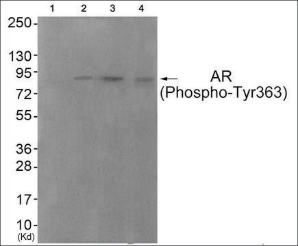 Anti-phospho-Androgen Receptor (pTyr363) antibody produced in rabbit affinity isolated antibody