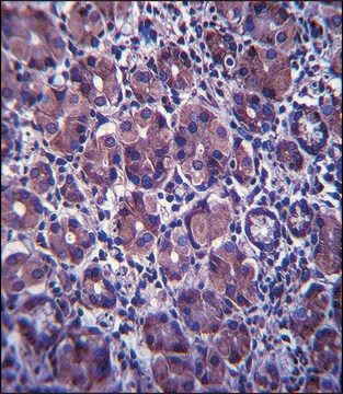 ANTI-ANKRD22 (C-TERM) antibody produced in rabbit IgG fraction of antiserum, buffered aqueous solution