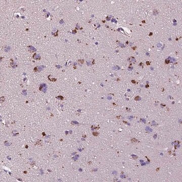 Anti-TM4SF20 antibody produced in rabbit Prestige Antibodies&#174; Powered by Atlas Antibodies, affinity isolated antibody, buffered aqueous glycerol solution