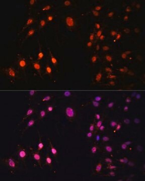 Anti-SETD2 antibody produced in rabbit