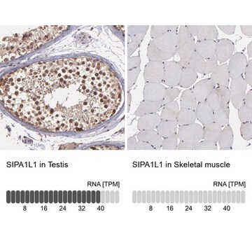 Anti-SIPA1L1 antibody produced in rabbit Prestige Antibodies&#174; Powered by Atlas Antibodies, affinity isolated antibody, buffered aqueous glycerol solution