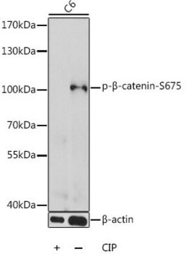 Anti-Phospho-beta Catenin-S675 antibody produced in rabbit