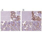 Anti-MME antibody produced in rabbit Prestige Antibodies&#174; Powered by Atlas Antibodies, affinity isolated antibody, buffered aqueous glycerol solution
