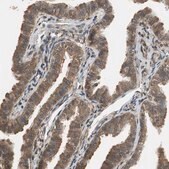 Anti-UBQLN2 antibody produced in rabbit Prestige Antibodies&#174; Powered by Atlas Antibodies, affinity isolated antibody, buffered aqueous glycerol solution