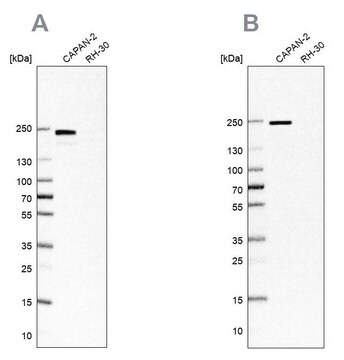 Anti-ITGB4 antibody produced in rabbit Prestige Antibodies&#174; Powered by Atlas Antibodies, affinity isolated antibody, buffered aqueous glycerol solution