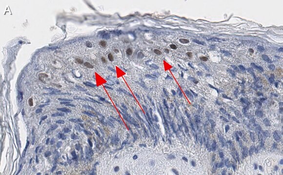 Anti-GRHL2 Antibody, clone 2N18 ZooMAb&#174; Rabbit Monoclonal recombinant, expressed in HEK 293 cells