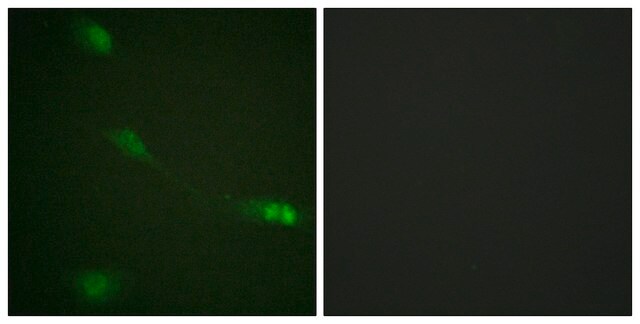 Anti-MDM2 antibody produced in rabbit affinity isolated antibody