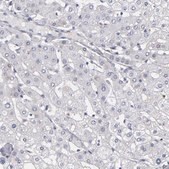 Anti-MGAM antibody produced in rabbit Prestige Antibodies&#174; Powered by Atlas Antibodies, affinity isolated antibody, buffered aqueous glycerol solution