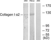 Anti-Collagen I &#945;2 antibody produced in rabbit affinity isolated antibody