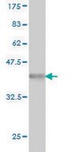 Monoclonal Anti-PARP1 antibody produced in mouse clone 3G4, purified immunoglobulin, buffered aqueous solution