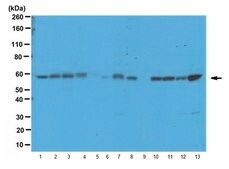 Anti-PKM2 Antibody serum, from rabbit