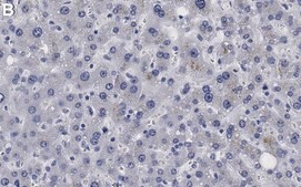 Anti-ABCA1 Antibody, clone 1J11 ZooMAb&#174; Rabbit Monoclonal recombinant, expressed in HEK 293 cells