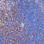 Anti-PI3 Kinase p110 delta antibody produced in rabbit