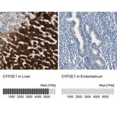 Anti-CYP2E1 antibody produced in rabbit Prestige Antibodies&#174; Powered by Atlas Antibodies, affinity isolated antibody, buffered aqueous glycerol solution