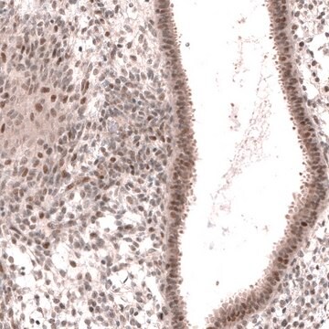 Anti-MGA antibody produced in rabbit Prestige Antibodies&#174; Powered by Atlas Antibodies, affinity isolated antibody, buffered aqueous glycerol solution