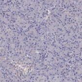 Anti-SCNN1D antibody produced in rabbit Prestige Antibodies&#174; Powered by Atlas Antibodies, affinity isolated antibody, buffered aqueous glycerol solution