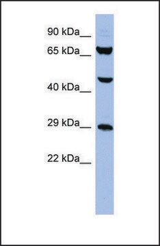 Anti-SNRPB, (N-terminal) antibody produced in rabbit affinity isolated antibody