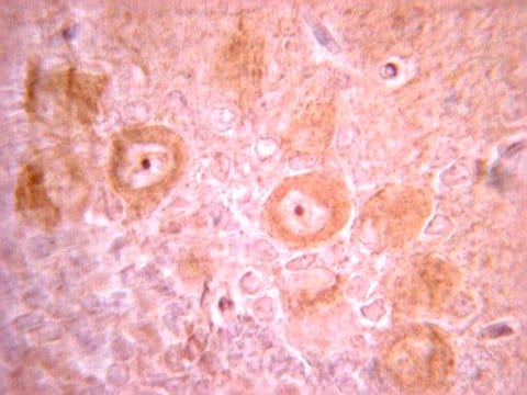 Anti-PDGFR Antibody, clone CH-3 clone CH-3, from mouse