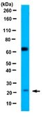 Anti-VEGF 165b Antibody, clone 56/1 clone 56/1, 1&#160;mg/mL, from mouse
