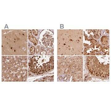 Anti-PSMD1 antibody produced in rabbit Prestige Antibodies&#174; Powered by Atlas Antibodies, affinity isolated antibody, buffered aqueous glycerol solution