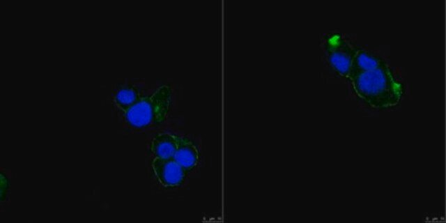 Anti-TRPV2 Antibody, clone 17A11 clone 17A11, from mouse