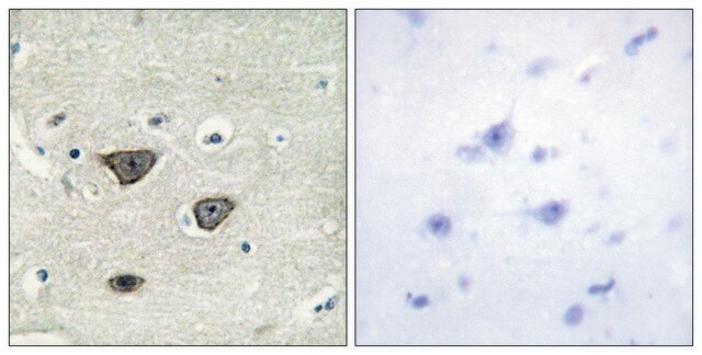 Anti-CDH8 antibody produced in rabbit affinity isolated antibody