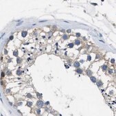 Anti-PGR antibody produced in rabbit Prestige Antibodies&#174; Powered by Atlas Antibodies, affinity isolated antibody, buffered aqueous glycerol solution