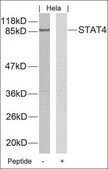 Anti-STAT4 (Ab-693) antibody produced in rabbit affinity isolated antibody