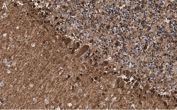 Anti-S100-B Antibody, clone 8F20 ZooMAb&#174; Rabbit Monoclonal recombinant, expressed in HEK 293 cells