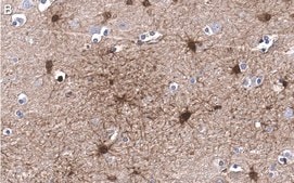 Anti-BLBP/FABP7 Antibody, clone 7I23, ZooMAb&#174; Rabbit Monoclonal recombinant, expressed in HEK 293 cells