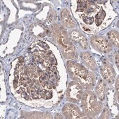 Anti-EPB41L5 antibody produced in rabbit Prestige Antibodies&#174; Powered by Atlas Antibodies, affinity isolated antibody, buffered aqueous glycerol solution