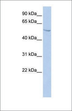 Anti-SUFU antibody produced in rabbit affinity isolated antibody