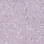 Anti-CAMK2A antibody produced in rabbit Prestige Antibodies&#174; Powered by Atlas Antibodies, affinity isolated antibody, buffered aqueous glycerol solution