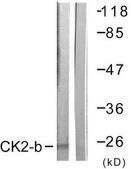 Anti-CKII-&#946; antibody produced in rabbit affinity isolated antibody