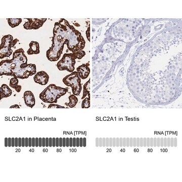 Anti-SLC2A1 antibody produced in rabbit affinity isolated antibody, buffered aqueous glycerol solution