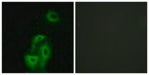 Anti-5-HT-2A antibody produced in rabbit affinity isolated antibody