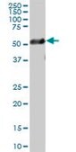 Anti-TUBB1 antibody produced in mouse purified immunoglobulin, buffered aqueous solution