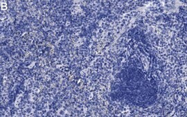 Anti-IL-6 Antibody, clone 1G18 ZooMAb&#174; Rabbit Monoclonal recombinant, expressed in HEK 293 cells