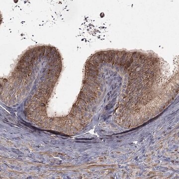 Anti-Olfml1 Antibody Produced In Rabbit Prestige Antibodies&#174; Powered by Atlas Antibodies, affinity isolated antibody, buffered aqueous glycerol solution