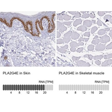 Anti-PLA2G4E antibody produced in rabbit Prestige Antibodies&#174; Powered by Atlas Antibodies, affinity isolated antibody, buffered aqueous glycerol solution